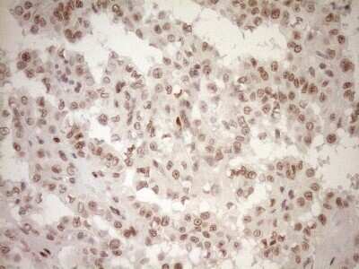 Immunohistochemistry: LXR alpha/NR1H3 Antibody (OTI1A5) [NBP2-46220]