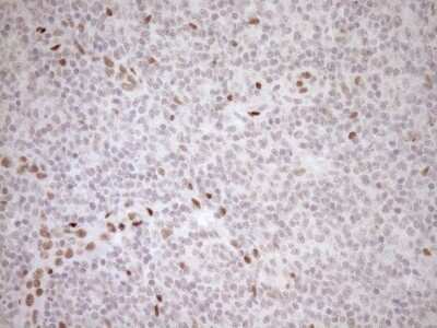 Immunohistochemistry: LXR alpha/NR1H3 Antibody (OTI1A5) [NBP2-46220]