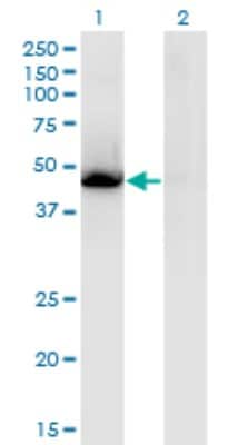 Western Blot: LXR alpha/NR1H3 Antibody (3E9) [H00010062-M08]