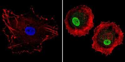 Immunocytochemistry/ Immunofluorescence: LXR alpha/NR1H3 Antibody [NB300-612]