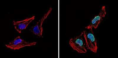 Immunocytochemistry/ Immunofluorescence: LXR alpha/NR1H3 Antibody [NB300-612]