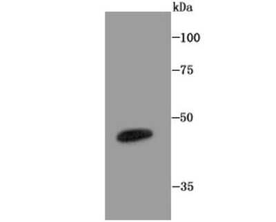 Western Blot: LXR alpha/NR1H3 Antibody (JA20-38) [NBP2-66938]