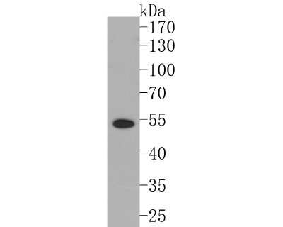 Western Blot: LXR alpha/NR1H3 Antibody (JA20-38) [NBP2-66938]