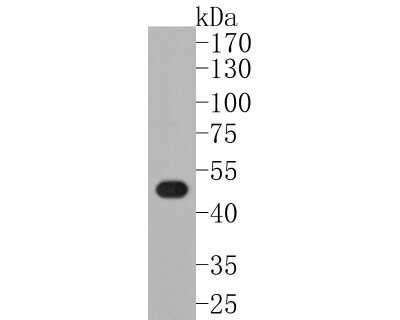 Western Blot: LXR alpha/NR1H3 Antibody (JA20-38) [NBP2-66938]