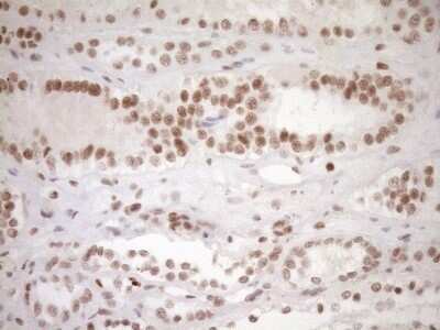 Immunohistochemistry: LXR alpha/NR1H3 Antibody (OTI1A5) - Azide and BSA Free [NBP2-72550]