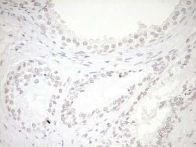 Immunohistochemistry: LXR alpha/NR1H3 Antibody (OTI1A5) - Azide and BSA Free [NBP2-72550]