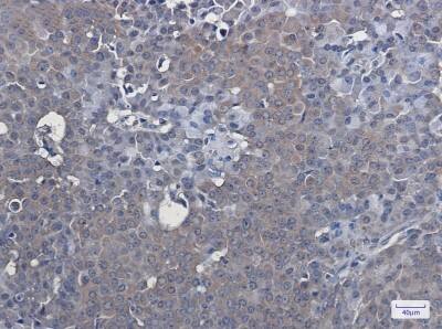 Immunohistochemistry-Paraffin: LXR alpha/NR1H3 Antibody (S07-6A4) [NBP3-19682]