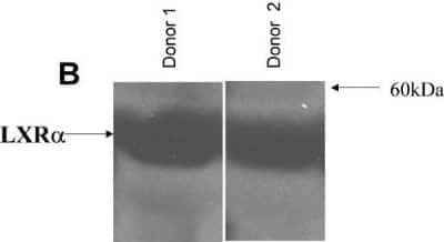 Western Blot: LXR alpha/NR1H3 Antibody [NB300-612]