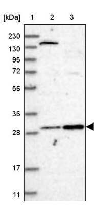 Western Blot: LXR alpha/NR1H3 Antibody [NBP1-92086]