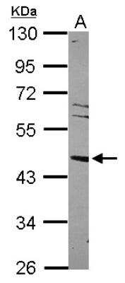 Western Blot: LXR alpha/NR1H3 Antibody [NBP2-17186]