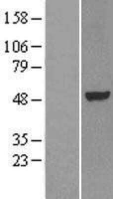 Western Blot: LXR alpha/NR1H3 Overexpression Lysate [NBL1-13768]