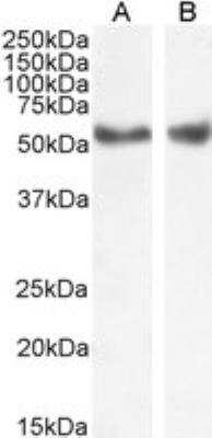 Western Blot: LXR alpha/beta Antibody [NB100-1465]