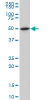 Western Blot: LXR beta/NR1H2 Antibody (1E1) [H00007376-M04]