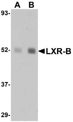 Western Blot: LXR beta/NR1H2 AntibodyBSA Free [NBP1-76256]