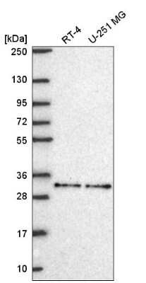 Western Blot: LXR beta/NR1H2 Antibody [NBP2-55918]