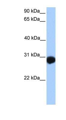 Western Blot: NTB-A/SLAMF6/CD352 Antibody [NBP1-62353]