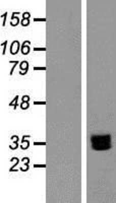 Western Blot: NTB-A/SLAMF6/CD352 Overexpression Lysate [NBP2-05839]