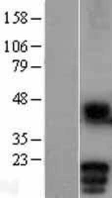 Western Blot: MD-1/LY86 Overexpression Lysate [NBL1-12750]