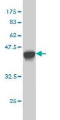 Western Blot: LYAG/GAA Antibody (3C6) [H00002548-M01]