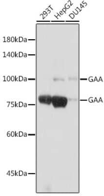 Western Blot: LYAG/GAA Antibody (5L2L10) [NBP3-15698]