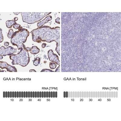 Immunohistochemistry-Paraffin: LYAG/GAA Antibody [NBP2-38142]