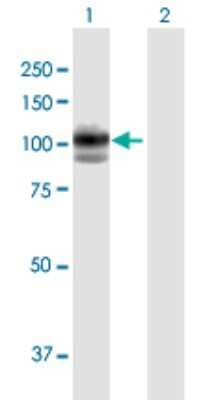 Western Blot: LYAG/GAA Antibody [H00002548-B01P]