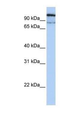 Western Blot: LYAG/GAA Antibody [NBP1-69295]