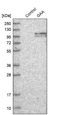 Western Blot: LYAG/GAA Antibody [NBP2-48576]