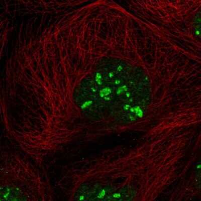 Immunocytochemistry/ Immunofluorescence: LYAR Antibody [NBP1-86827]