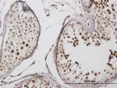 Immunohistochemistry-Paraffin: LYAR Antibody [H00055646-B02P]