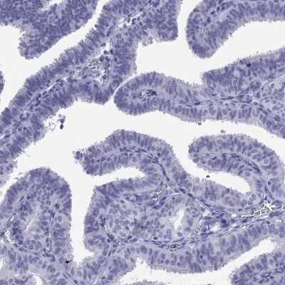 Immunohistochemistry-Paraffin: LYAR Antibody [NBP1-86827]