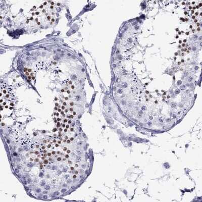 Immunohistochemistry-Paraffin: LYAR Antibody [NBP1-86827]