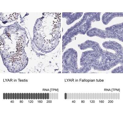 Immunohistochemistry-Paraffin: LYAR Antibody [NBP1-86827]