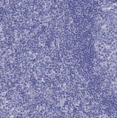 Immunohistochemistry-Paraffin: LYAR Antibody [NBP1-86827]