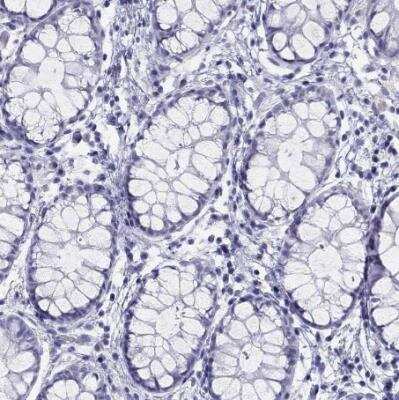 Immunohistochemistry-Paraffin: LYAR Antibody [NBP1-86827]