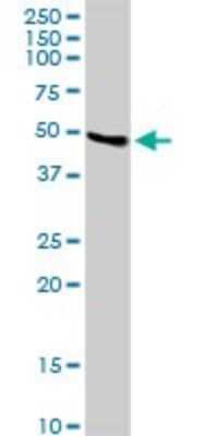 Western Blot: LYAR Antibody [H00055646-B01P]
