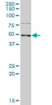 Western Blot: LYAR Antibody [H00055646-B01P]