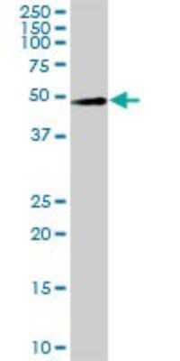 Western Blot: LYAR Antibody [H00055646-B02P]