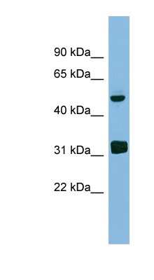 Western Blot: LYAR Antibody [NBP1-56474]