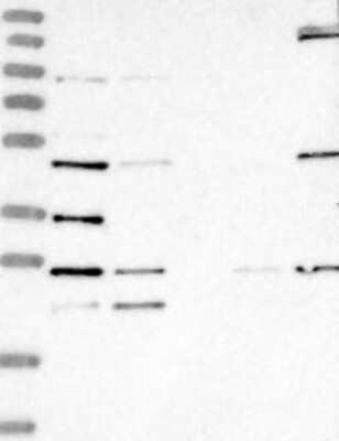 Western Blot: LYAR Antibody [NBP3-17733]