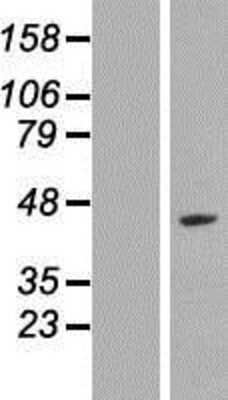 Western Blot: LYAR Overexpression Lysate [NBP2-06914]