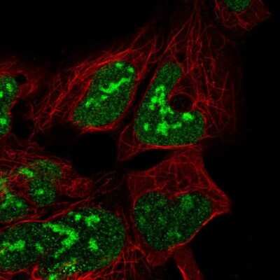 Immunocytochemistry/ Immunofluorescence: LYDG10 Antibody [NBP2-31849]