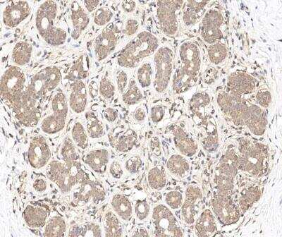 Immunohistochemistry-Paraffin: LYG2 Antibody [NBP3-12638]