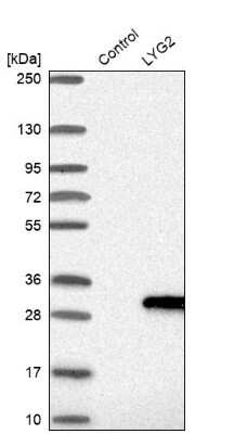 Western Blot: LYG2 Antibody [NBP1-81278]