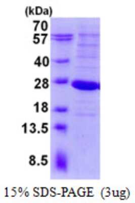 SDS-PAGE: Recombinant Human LYG2 His Protein [NBP2-23207]