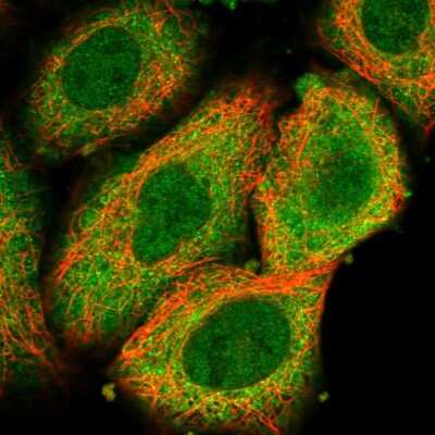 Immunocytochemistry/ Immunofluorescence: LYK5 Antibody [NBP1-89577]