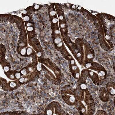 Immunohistochemistry-Paraffin: LYK5 Antibody [NBP1-89577]