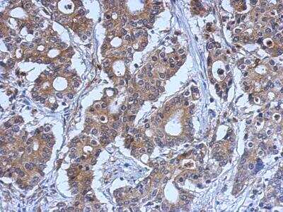 Immunohistochemistry-Paraffin: LYK5 Antibody [NBP2-17187]