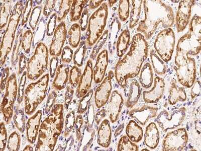 Immunohistochemistry-Paraffin: LYK5 Antibody [NBP2-99336]