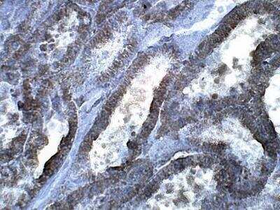 Immunohistochemistry-Paraffin: LYK5 Antibody [NBP3-12322]
